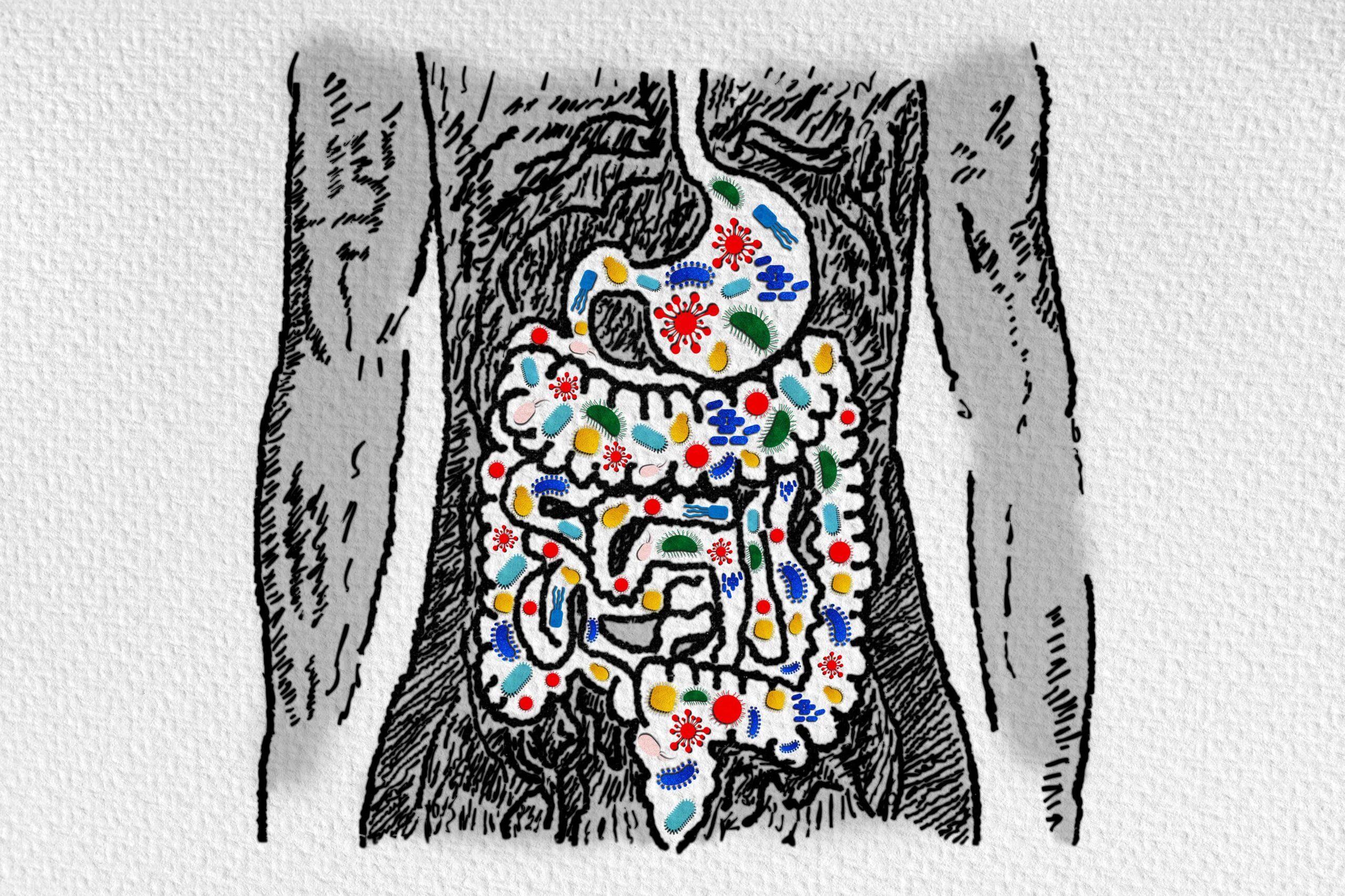 Gut Microbiome and Probiotics – Association with Gastrointestinal Diseases – Leaky Gut – Dysbiosis